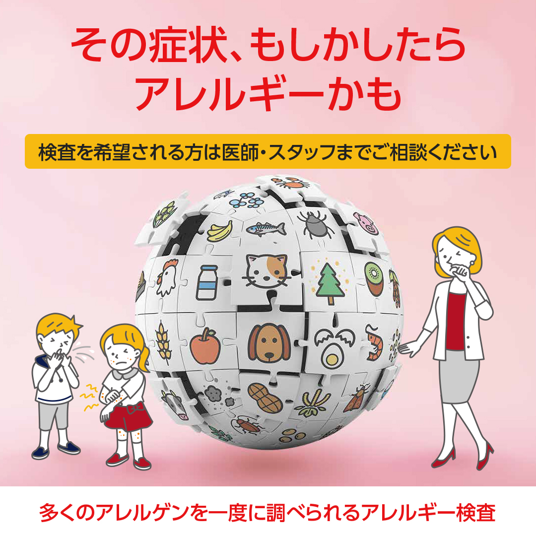 アレルギー検査は必要？意味はあるの？～VIEW39で39種類のアレルギーを一度にチェック～