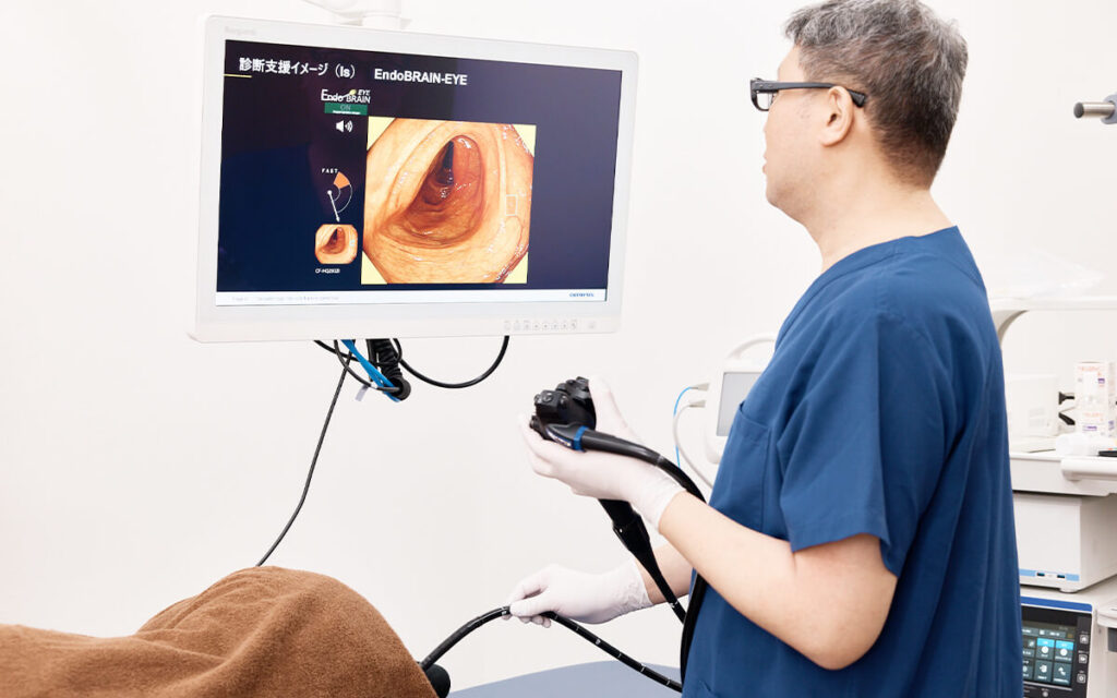 内視鏡(胃・大腸カメラ)検査の様子
