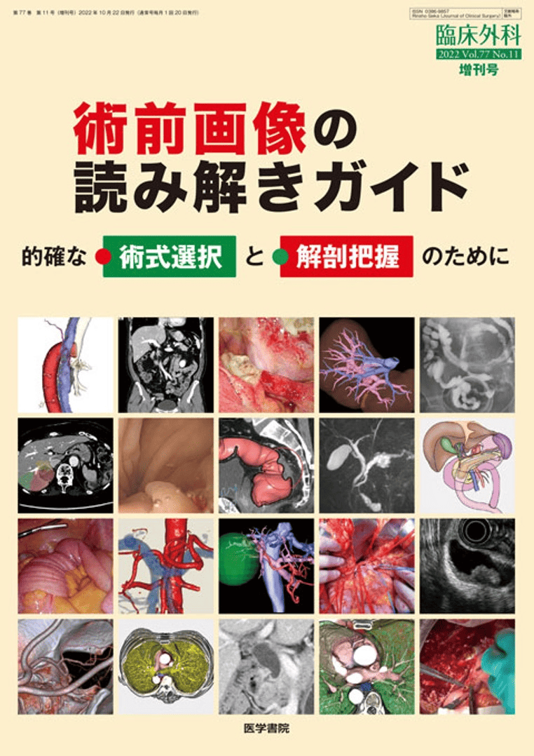 術前画像の読み解きガイド