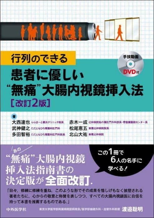 行列のできる患者にやさしい”無痛”大腸内視鏡挿入法