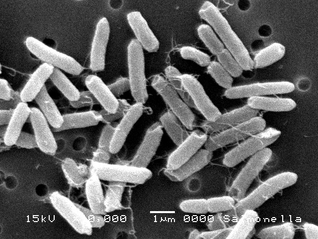 豊島区 消化器内科・肛門科が専門で食中毒に対して無痛大腸カメラ施行した際の原因がサルモネラでサルモネラ菌属の電子顕微鏡写真