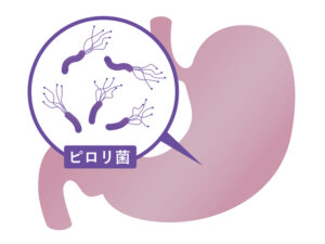 ピロリ菌イラスト　豊島区　痛くない胃カメラ・大腸カメラ　消化器内科・肛門科　女性に配慮　胃がん検診　便潜血検査に対応