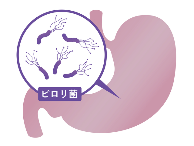 胃の中のピロリ菌をやっつける！