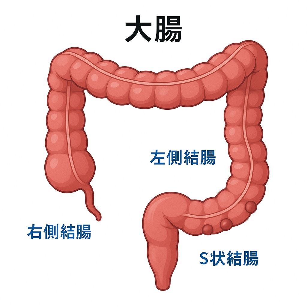 大腸憩室炎 大腸憩室のイラスト
