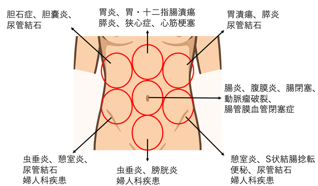 腹痛の部位別考えられる病気