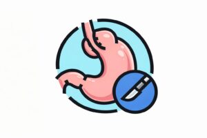 東京都豊島区大塚のおなかとおしりのクリニック 東京大塚の逆流性食道炎の手術のイラスト