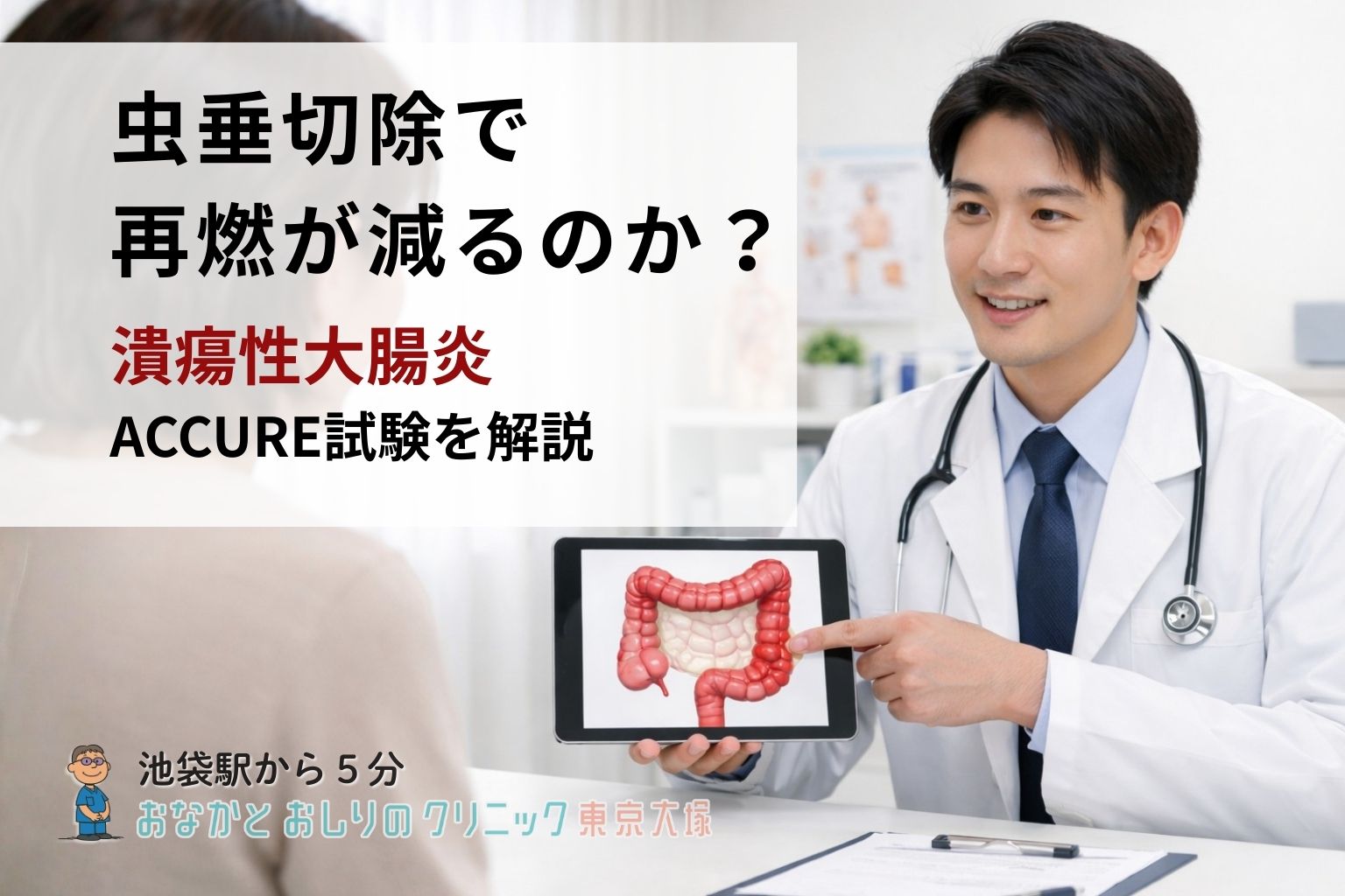 潰瘍性大腸炎、虫垂を切除すると再燃が減る？ACCURE試験が示した新しい選択肢