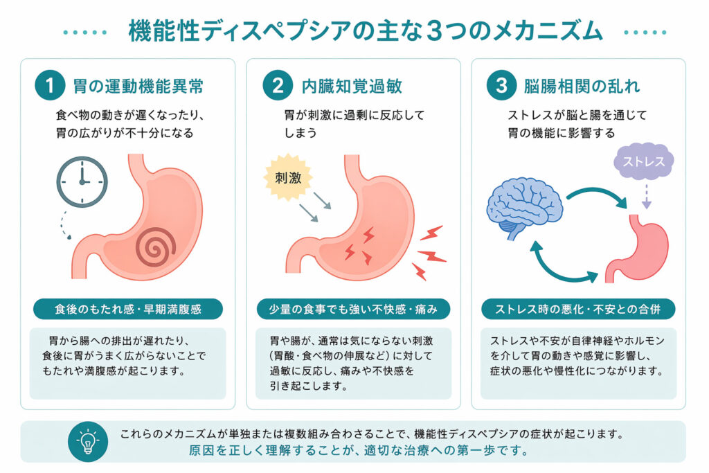 東京都豊島区大塚のおなかとおしりのクリニック 東京大塚の機能性ディスペプシアの原因イラスト