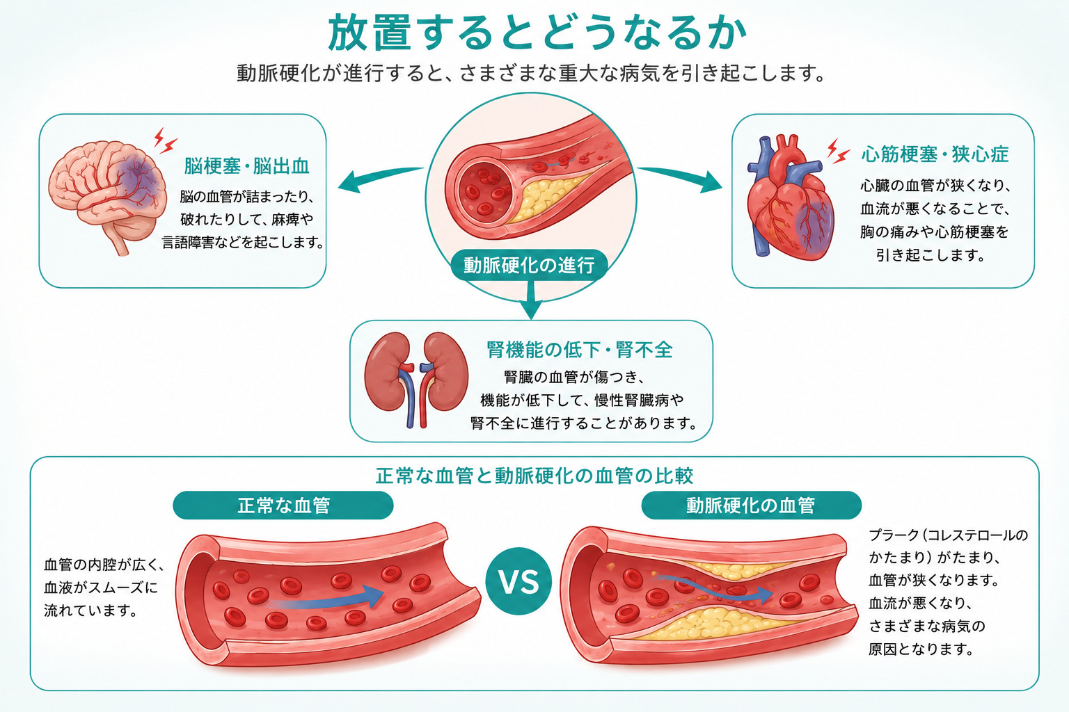 動脈硬化の影響イラスト
