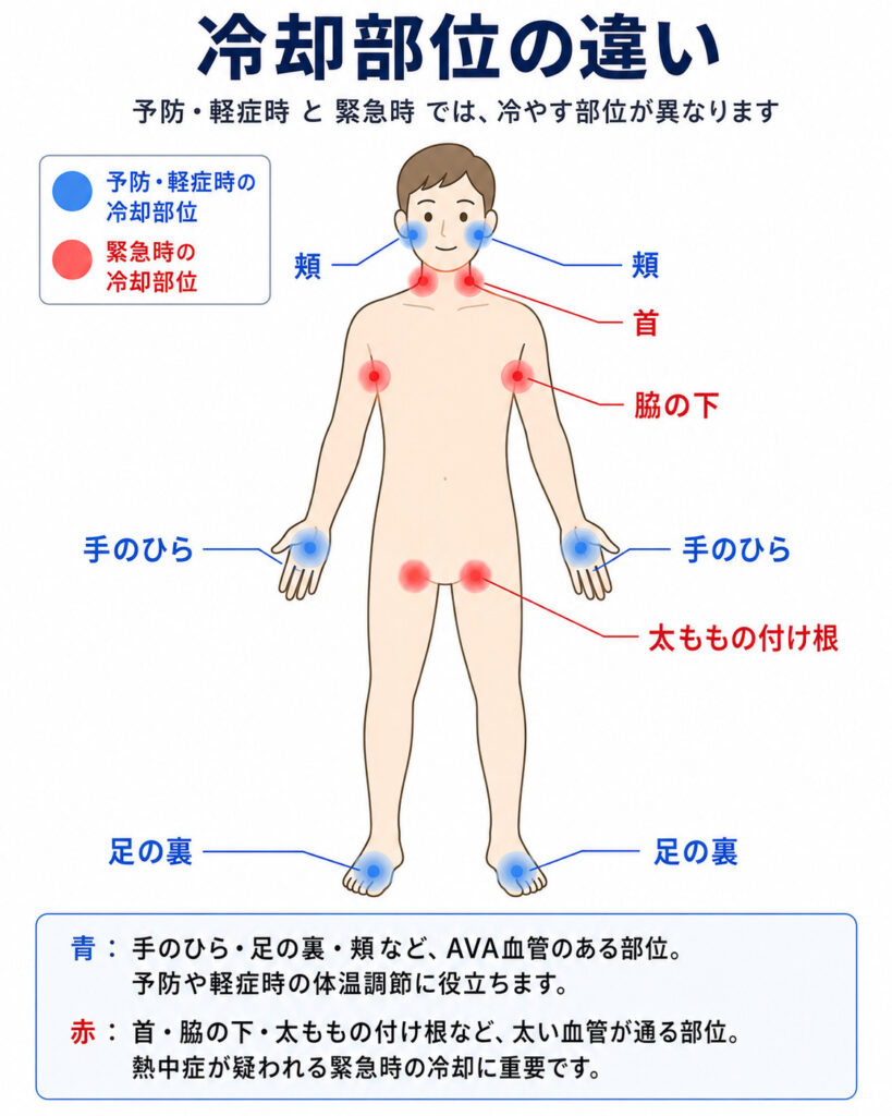 東京都豊島区おなかとしりのクリニック 東京大塚の冷却部位人体図イラスト
