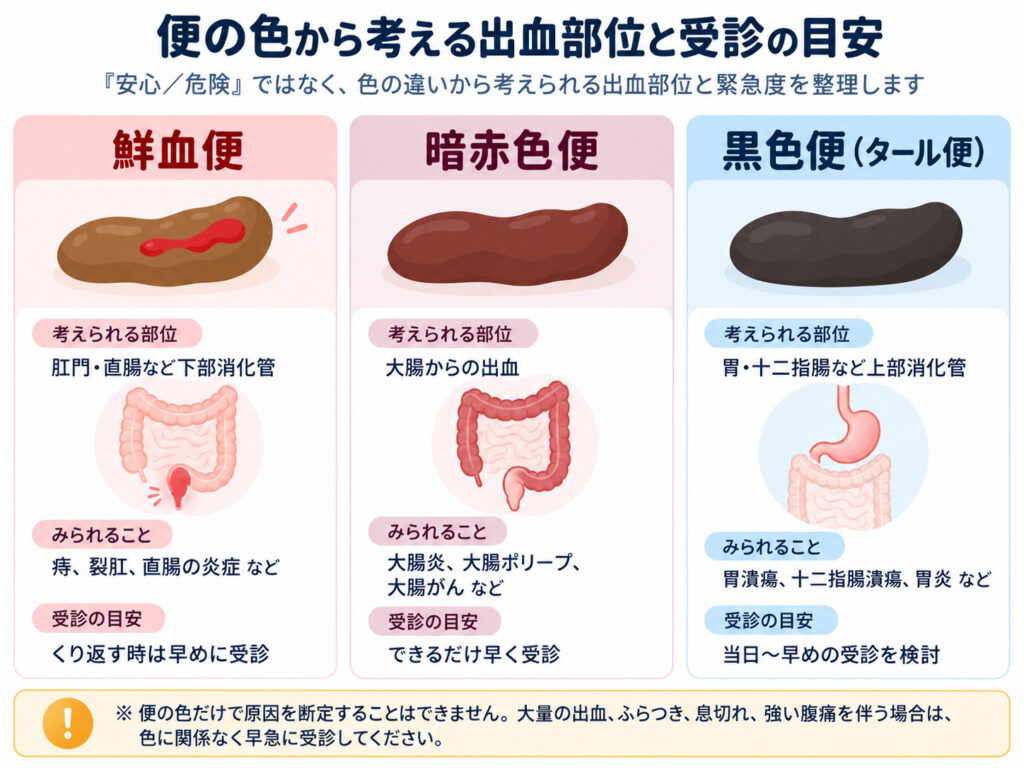 東京都豊島区大塚のおなかとおしりのクリニック 東京大塚の便の色イラスト