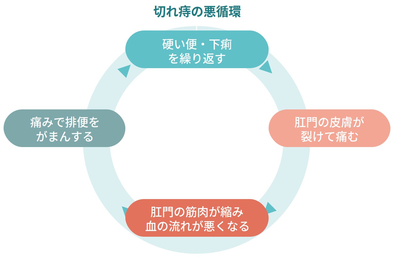 切れ痔が繰り返される悪循環