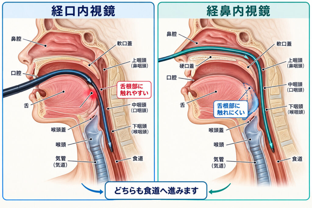 口から入れる胃カメラと鼻から入れる胃カメラの経路の比較。鼻からの経路は舌の付け根に触れにくい
