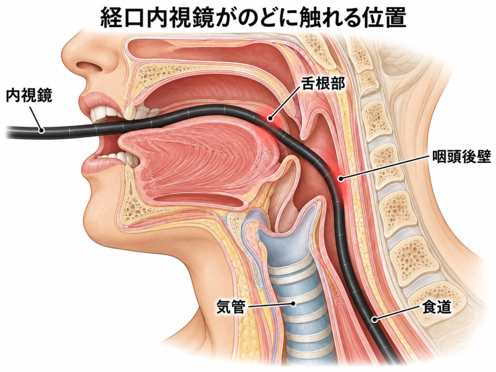 口から入れた内視鏡が舌の付け根とのどの奥に触れる位置を示した、のどの断面図